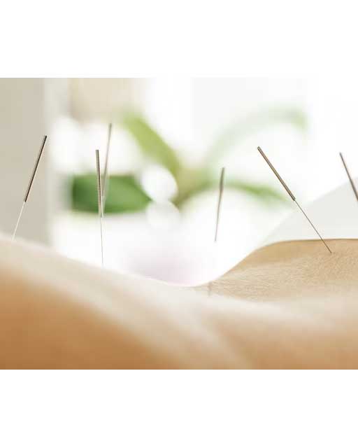 Acupuncture- Integration and Skepticism